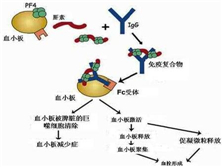 肝素诱导性血小板减少症
