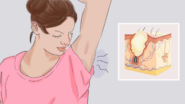 狐臭会引起女生下面异味大嘛