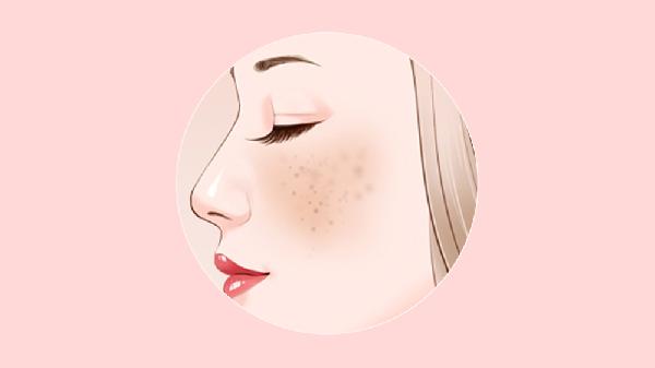 妊娠斑去的掉吗 淡化妊娠斑的方法