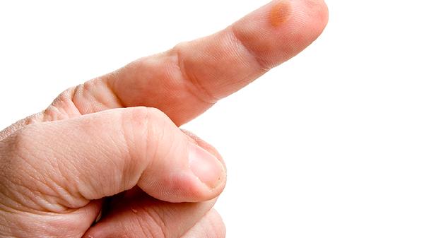 皮肤暗沉发黄怎么办?注意4种解决方法