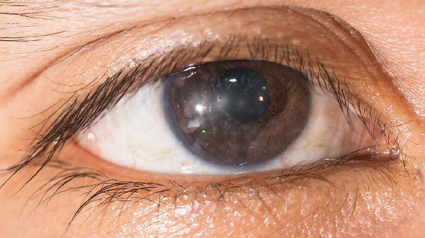 预防红眼病记住7个保健方法