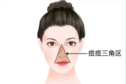 头顶长痘痘的原因和解决方法