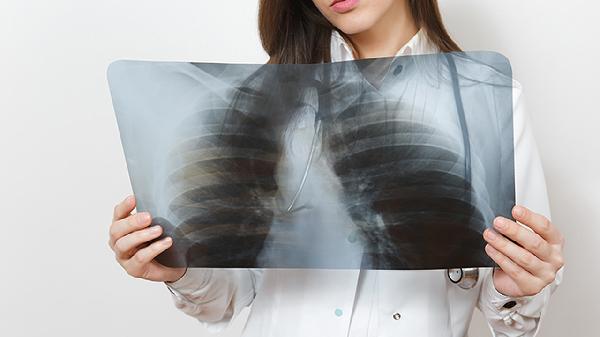 儿童腺样体肥大容易肺炎
